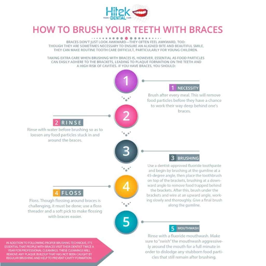 How to Brush Teeth with Braces | Hitek Family Dental Blog How to Brush Teeth with Braces | Hitek Family Dental Blog