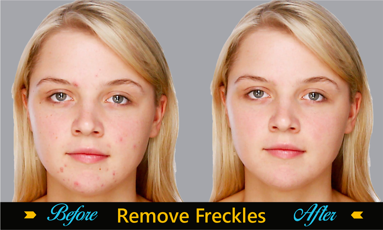 Freckles Remove on Face :: Behance