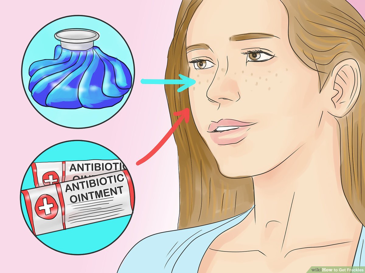How to Remove Freckles at Home: A Comprehensive Guide