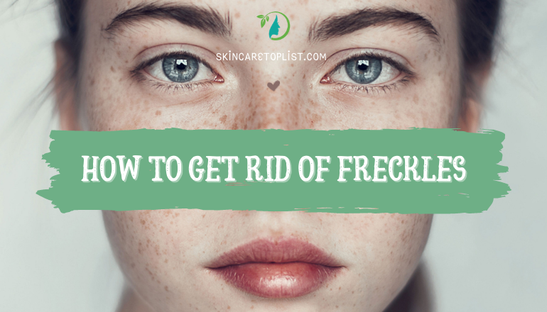 10+ Ways to Get Rid of Freckles - Skin Disease Remedies