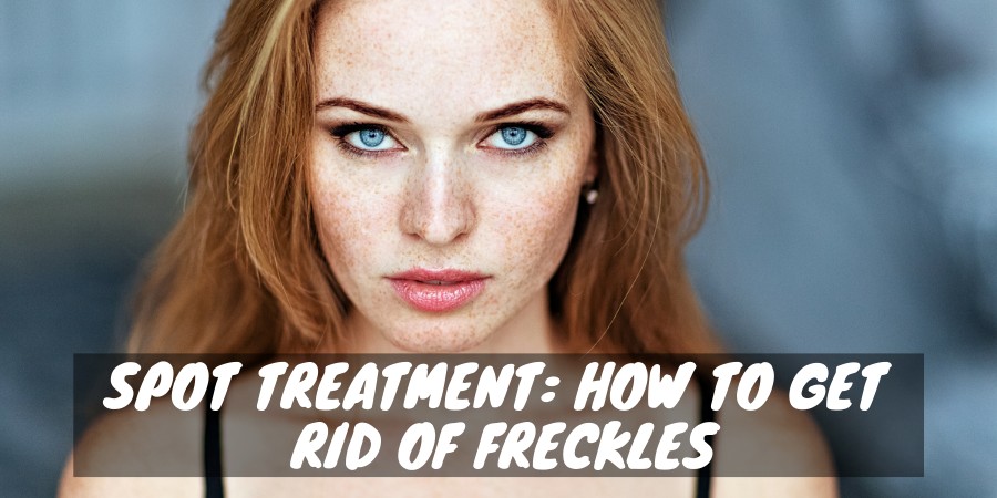 How to Get Rid of Freckles - Arlene Howard PR